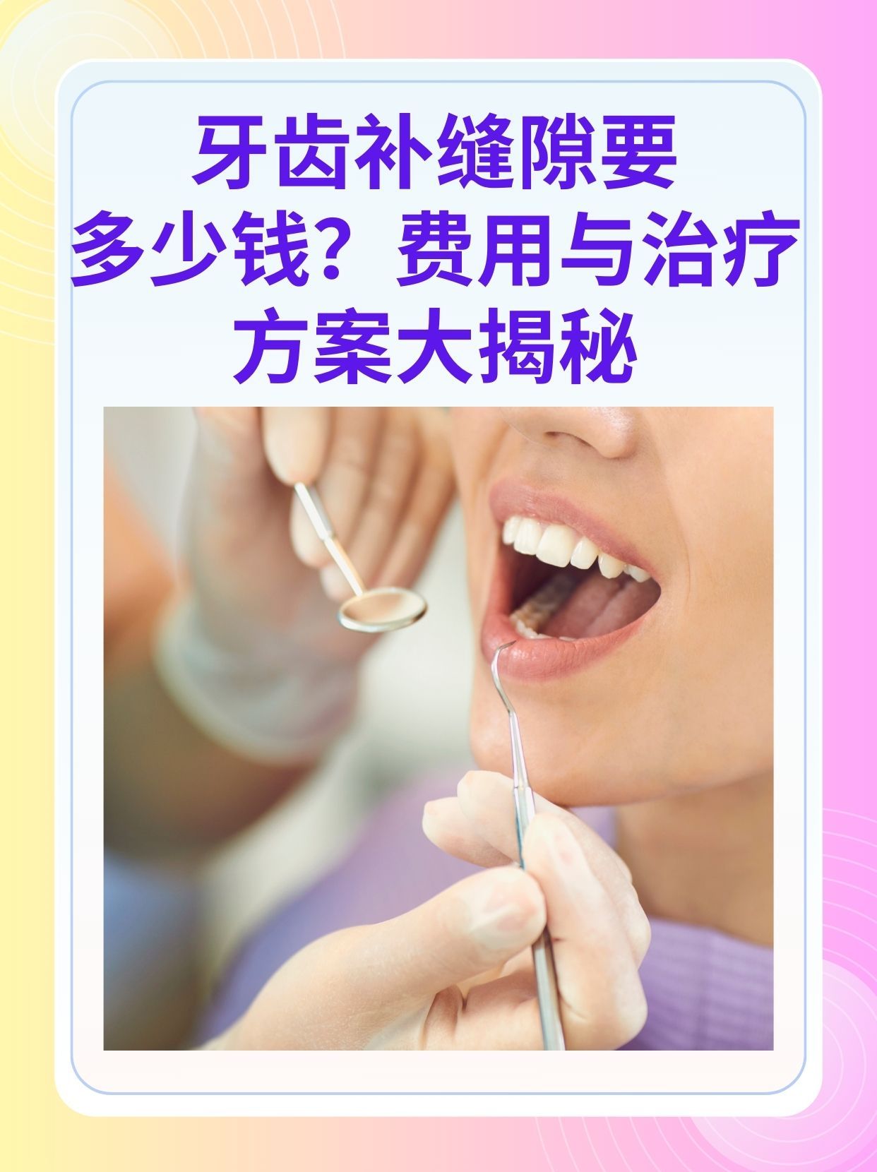 天津补牙医保可以报销吗(补牙医保可以报销吗 哪些可以报销呢)